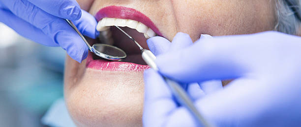 Best Dentist for Tooth Abscess  in Advae, NC
